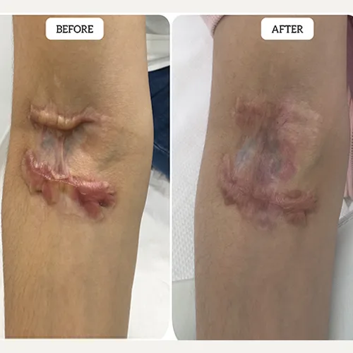 skin clinic abudhabi